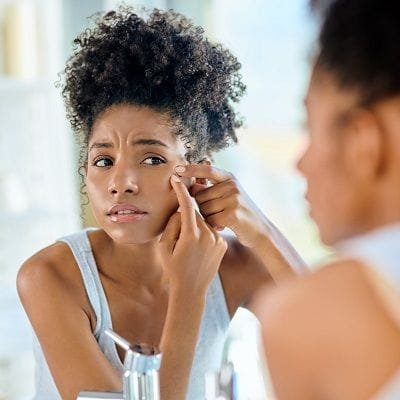 Hyperpigmentation Treatment for Black Skin