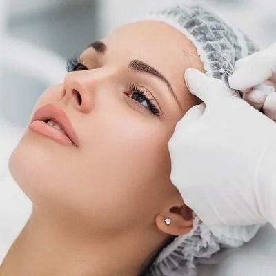Improve Smile lines with Nano Thread Lifts