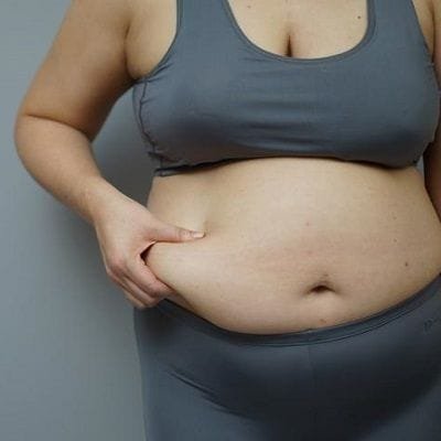 Is Weight Loss Surgery a Permanent Solution for Obesity