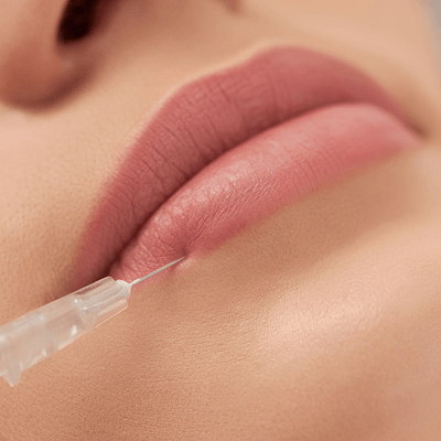 Lip Filler Cost In Dubai