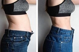 Liposuction Dubai Silicon Oasis Before & After