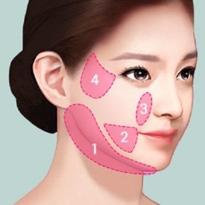 Liposuction for face