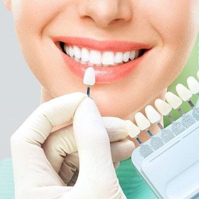 Make Your Veneers Last Longer- 5 Effective Tips To Follow