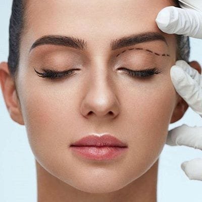Make your Eyes Younger With Blepharoplasty