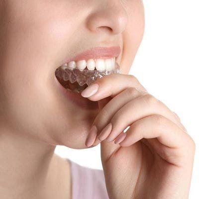 Mouth Guard In Dubai