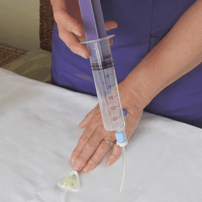 Optimal Home Enteral Nutrition