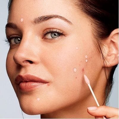 Pimples Treatment Cost in Dubai & Abu Dhabi