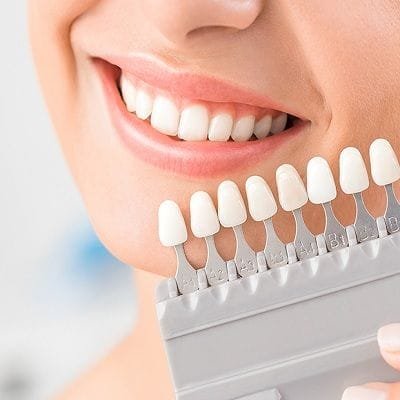 Porcelain Veneers Cost in Dubai