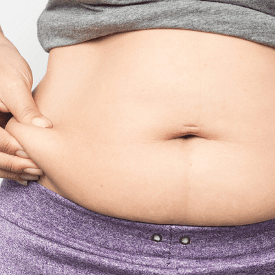Post Weight Loss Treatment Cost in Dubai & Abu Dhabi Dynamic