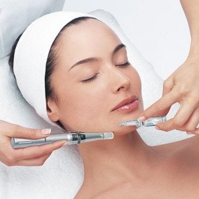 Prp Micro-needling For Hyperpigmentation in Dubai