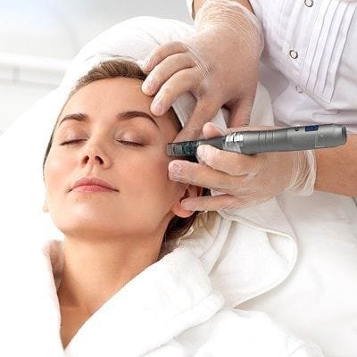 RF Microneedling Treatment Cost in Dubai