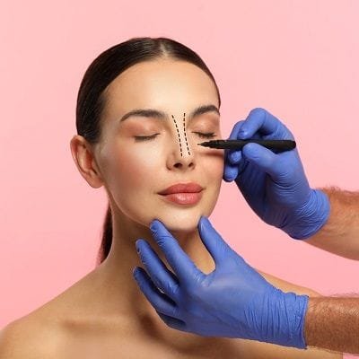Reduce Nose Bridge with Silicone Nose Surgery