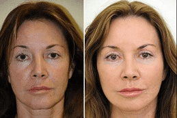Regenerative Medicine 5 Regenerative Medicine in Dubai