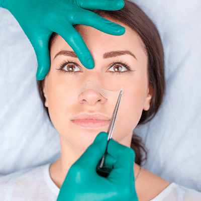 Rhinoplasty Recovery After Your Nose Job
