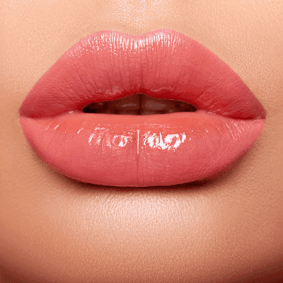 Russian Lips vs. Lip Fillers