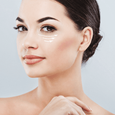 Say Goodbye to Tired Eyes The Dubai Guide to Eye Bag Removal