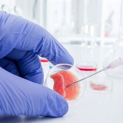 Stem Cell Therapy in Dubai