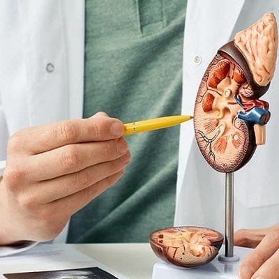 kidney Stones treatment in Dubai