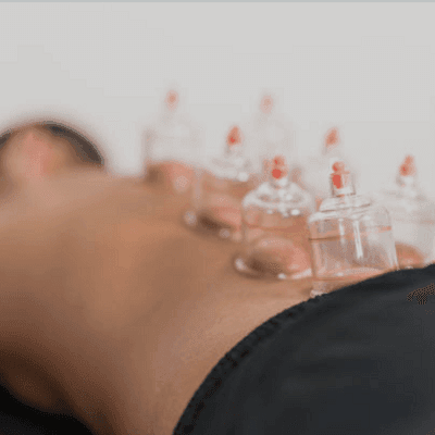 Sunnah Hijama in Dubai, Abu Dhabi & Sharjah