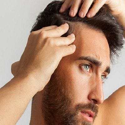 Synthetic Hair Transplant