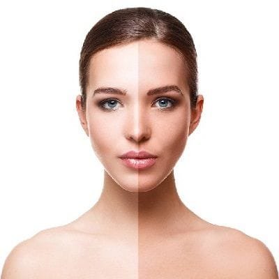 Tan Removal Treatment Cost
