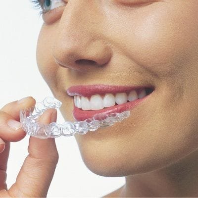 Teeth Aligners How Teeth Aligners Work