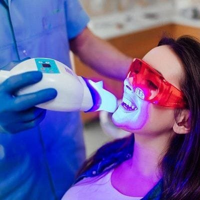 Teeth Whitening Deals and Offers