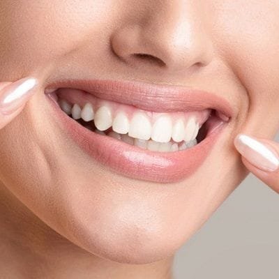 Teeth Whitening Dubai Silicon Oasis