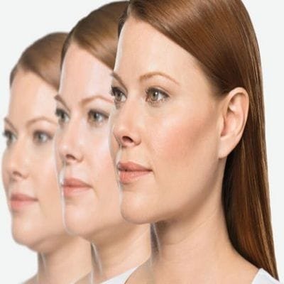 Things you should know Before Belkyra Treatment