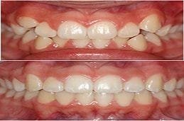 Top Orthodontists in Dubai