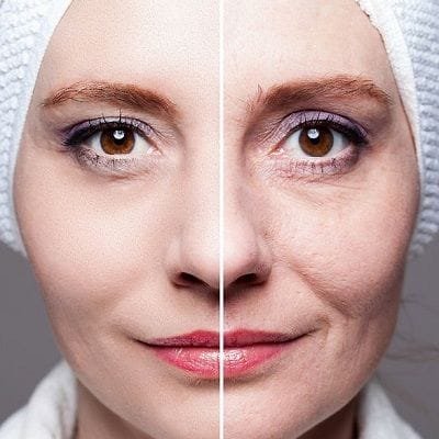 Treat Your Skin Concerns with Pico Laser Treatment