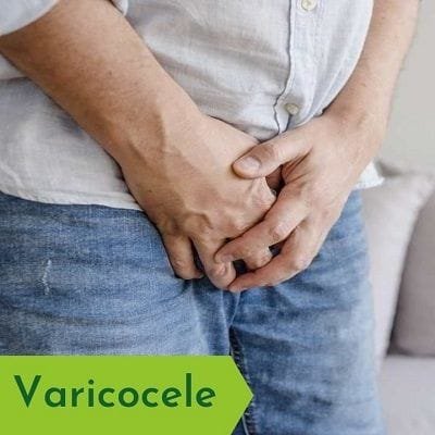 Varicoceles: Testicular Varicose Veins