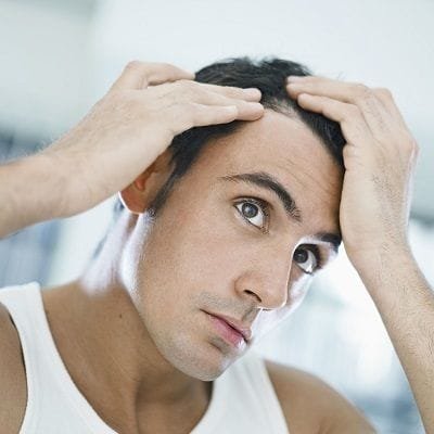 Various Strategies Available for Hair Implants in Dubai