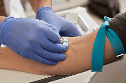 Vitamin D Tests at Home in Dubai