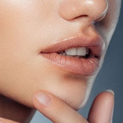 Volbella Fillers for Lips in Dubai