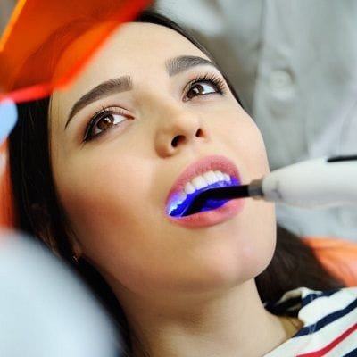 What Are The Types Of Dental Fillings In Dubai Dental Fillings Cost