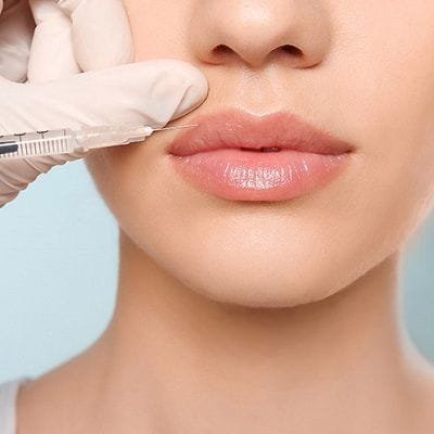 What Not To Do After Lip Injections