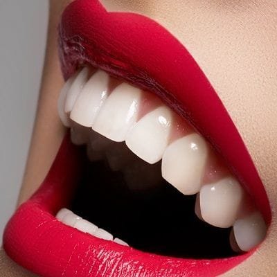 What Problems Does Hollywood Smile Solve?