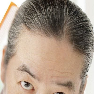 White Hair Removal
