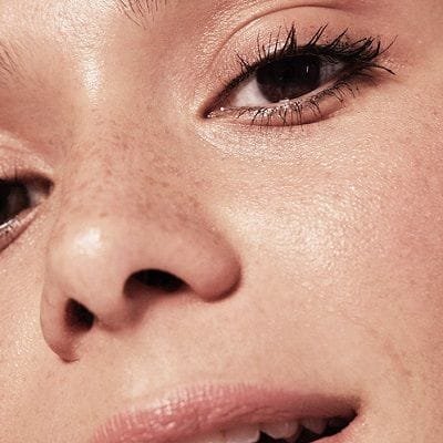 Why Does my Nose Have a Bump on the Bridge