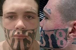 eyebrow-tattoo-removal in Abu Dhabi