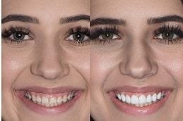 laser-gum-surgery Clinic in Dubai