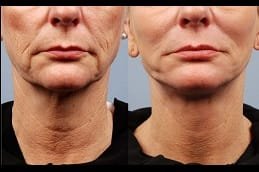 non-invasive in Abu Dhabi