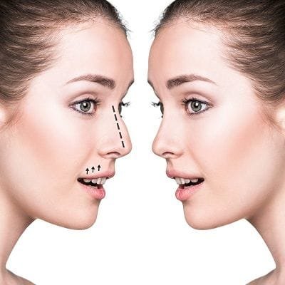 non surgical nose job dubai