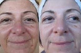 Skin Diseases 5 skin-diseases Clinic in Dubai