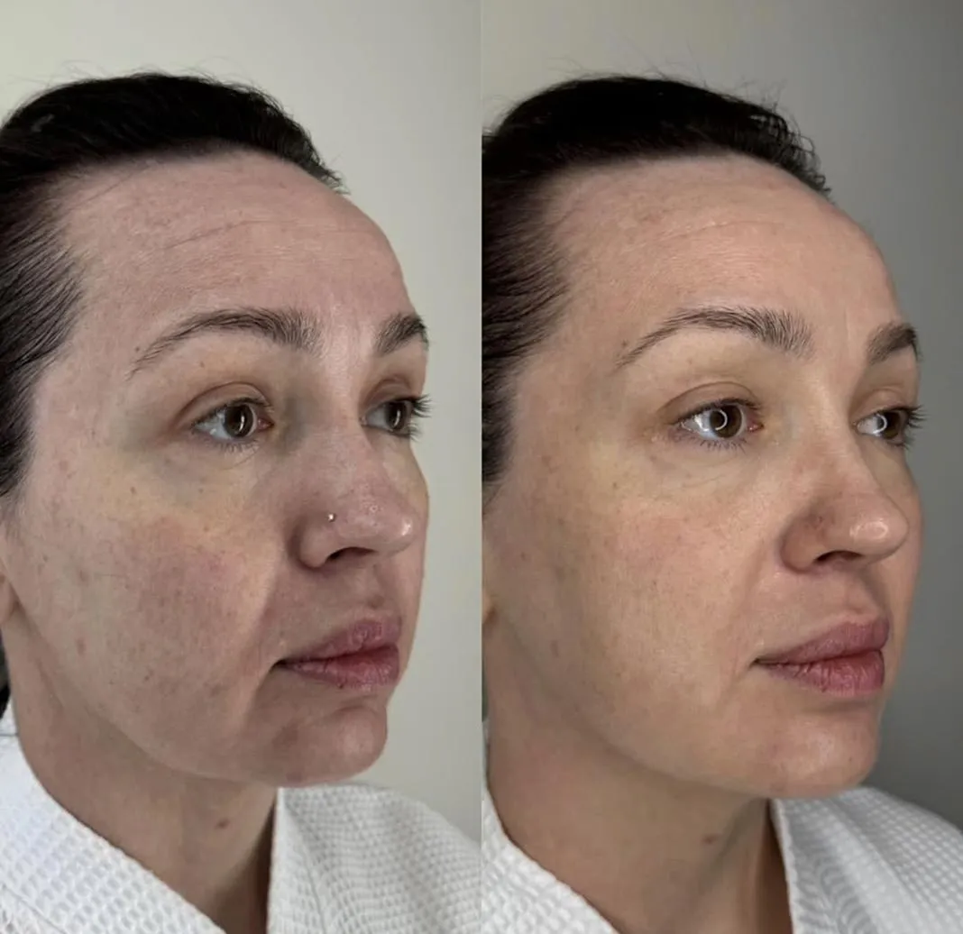 Dynamic Life Clinics 152 Dynamic Life Clinics - Skin Whitening - Before & After