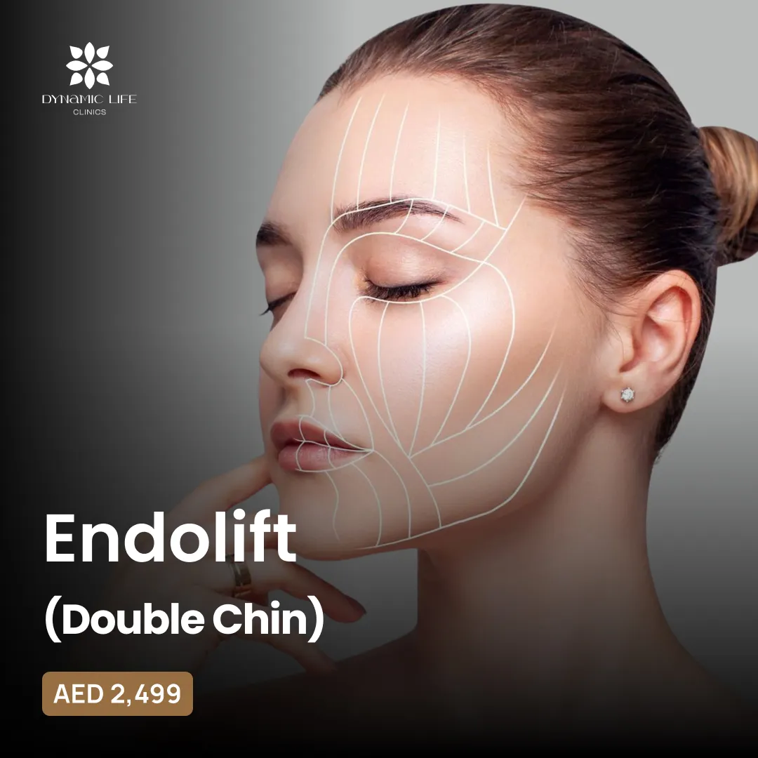 Endolift