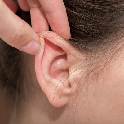 Ear Reshaping Surgery