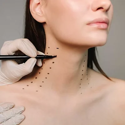 Nefertiti Lift Treatment