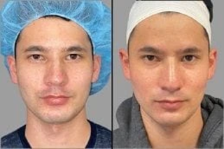 Enlighten Pico Genesis Before and After